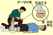 きれいなガーゼやハンカチなどを傷口に当て手で圧迫するイメージ画像