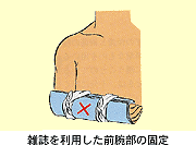 雑誌を利用した前腕部の固定 イラスト画像