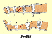 足の固定 イラスト画像