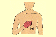 片手の手のひらの面積が体表面積の1％であるイメージ画像